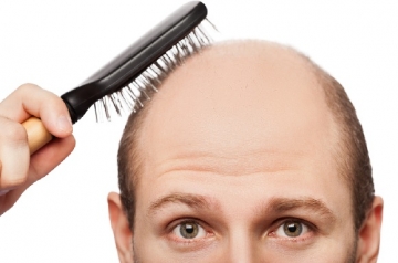 Baş dermatoveneroloq: “Saç tökülməsi problemi daha çox kişilərdə müşahidə olunur”