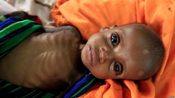 Somalidə 100-dən çox adam acından ölüb