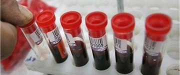 Pulsuz dərmanla təmin edilən hepatitli xəstələrin sayı açıqlandı