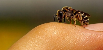 Arı sancması hansı fəsadlara səbəb olur? 