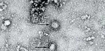 Avstraliya alimləri yeni bir koronavirus yetişdirə bildilər