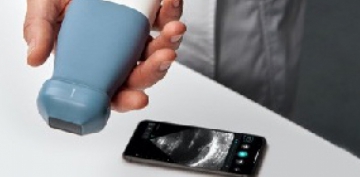 Smartfon vasitəsilə xəstəliklərin diaqnozu üçün cib ultrasəs aparatı yaradılıb