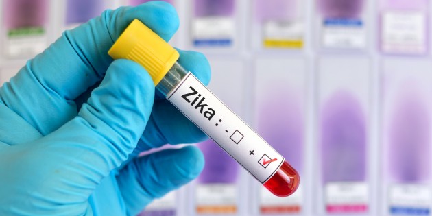 Zika virusunun qadından kişiyə keçmə halı ilk olaraq ABŞ-da qeydə alınıb