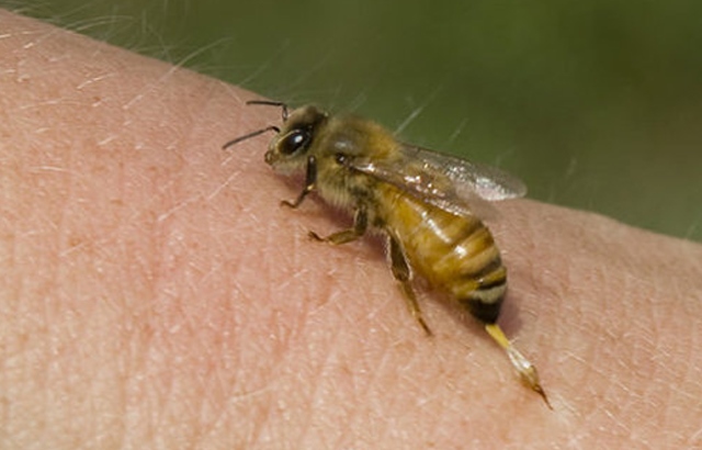 Yayın şirin bəlası: arı sancması zamanı bunları edin - TƏBİİ ÜSULLAR