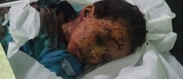Səud qüvvələrinin məktəbi bombardmanı nəticəsində 28 uşaq yaralanıb