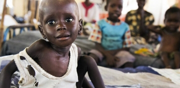 Cənubi Sudanda 20 min uşaq aclıqdan ölə bilər 