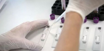 ÜST: hazırda 17 koronavirus peyvəndi klinik sınaqdadır