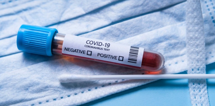 Azərbaycanda koronavirusa 4 077 yeni yoluxma qeydə alınıb, 43 nəfər vəfat edib